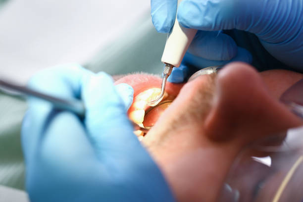 Best Urgent Care for Lost Fillings or Crowns in Long Branch, VA