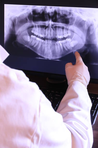 Best Emergency Dental Care for Broken or Chipped Teeth in Long Branch, VA