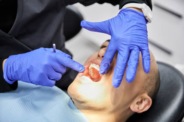 Best Same-Day Emergency Dental Services in Long Branch, VA